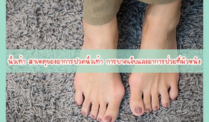 นิ้วเท้า สาเหตุของอาการปวดนิ้วเท้า การบาดเจ็บและอาการป่วยที่ผิวหนัง